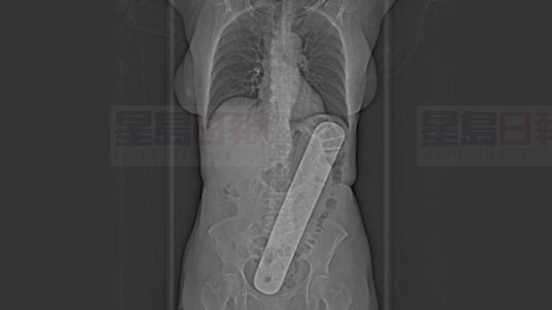 ggggggggggggggggggggggggg