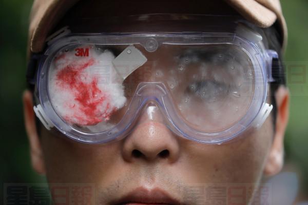 A pro-democracy protester with his eye covered in red-eyepatch, symbolizing a women who lost her eyesight during a previous demonstration due to clashes with police, participates in a march organized by teachers in Hong Kong Saturday, Aug. 17, 2019. Members of China's paramilitary People's Armed Police marched and practiced crowd control tactics at a sports complex in Shenzhen across from Hong Kong in what some interpreted as a threat against pro-democracy protesters in the semi-autonomous territory. (AP Photo/Vincent Yu)