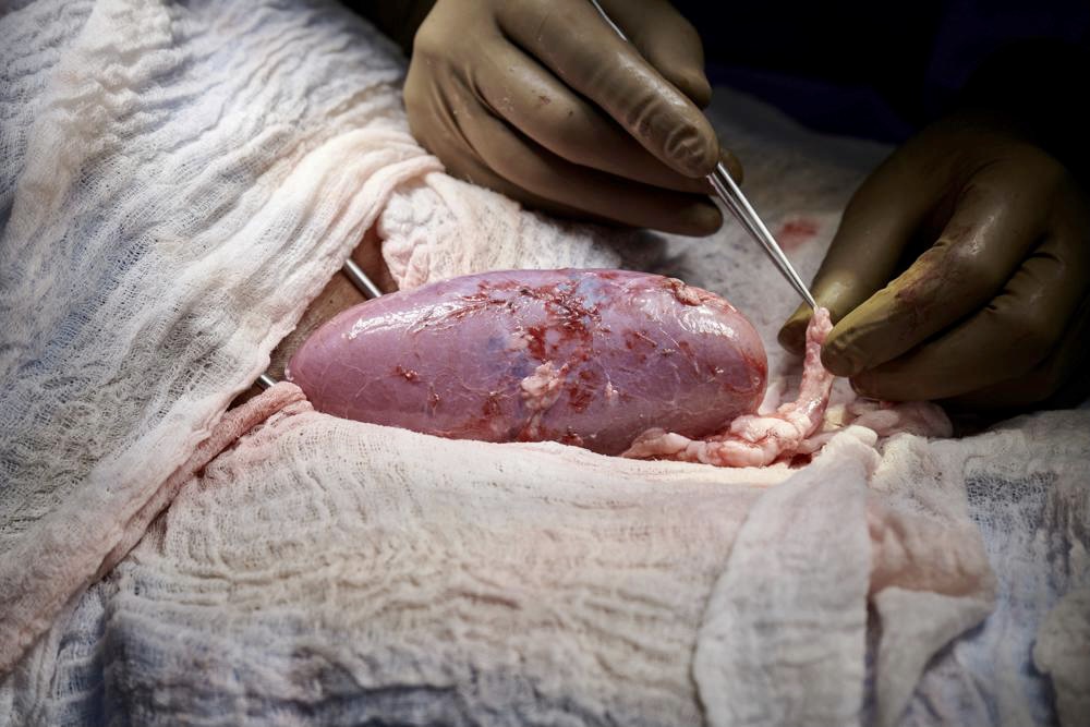 7739DDB3-AE39-413F-9BB4-6981A138D826