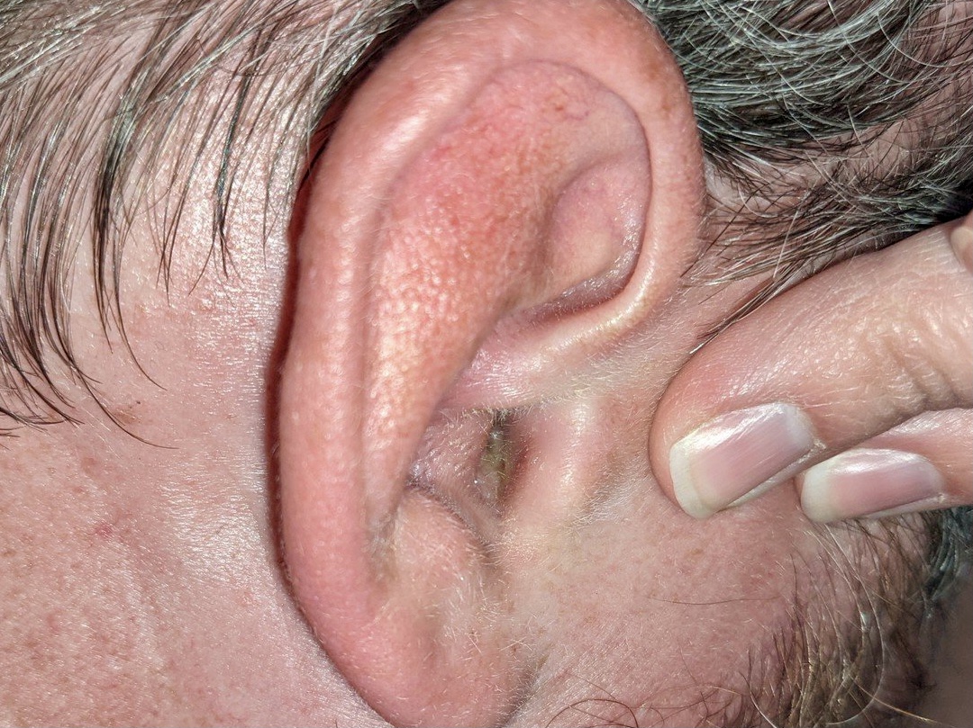 D154CA8E-AFEE-49E1-8A6A-B2EEECB52965