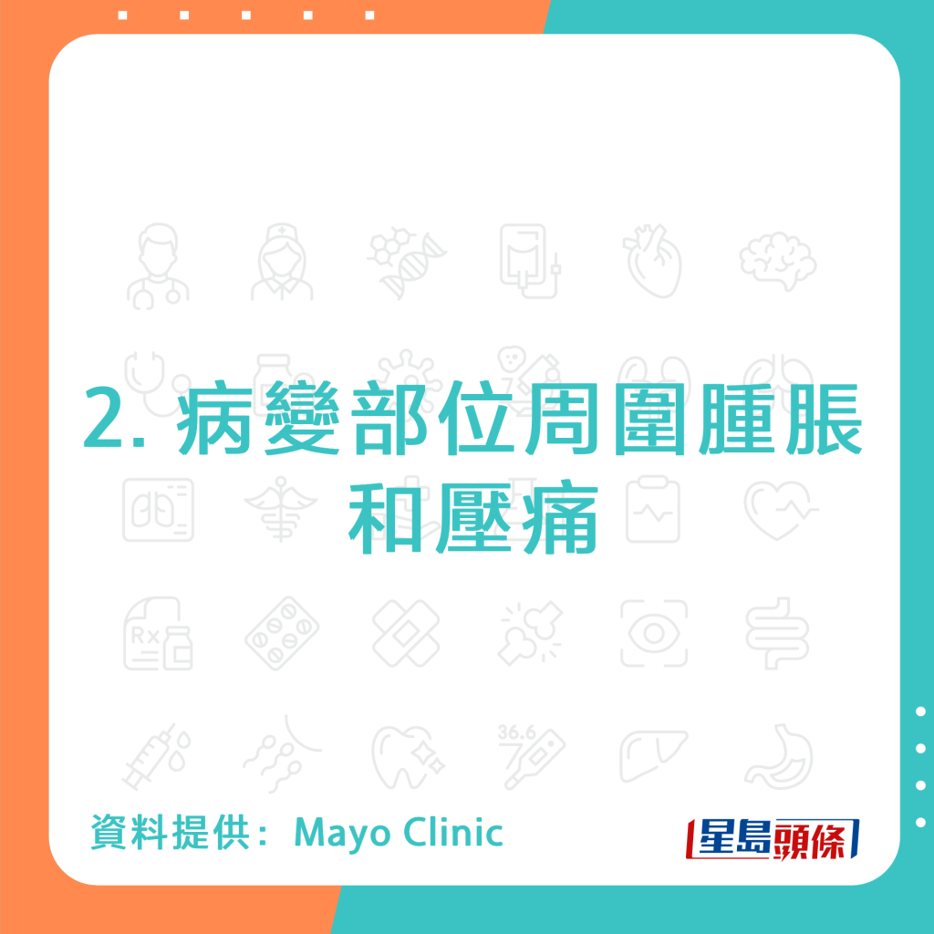 20220929_health_bone cancer_2