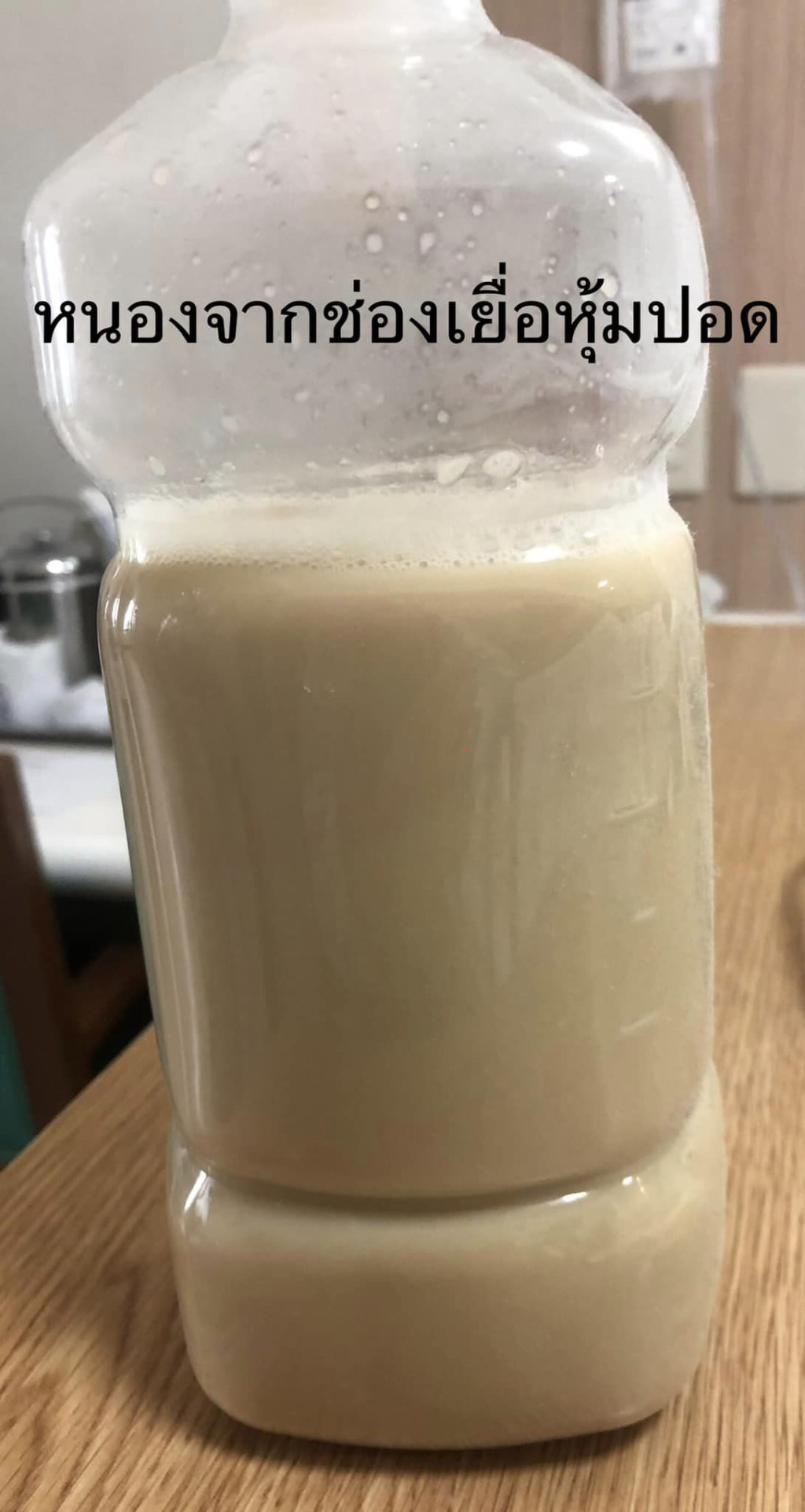 20220930_Health_teeth decay_2