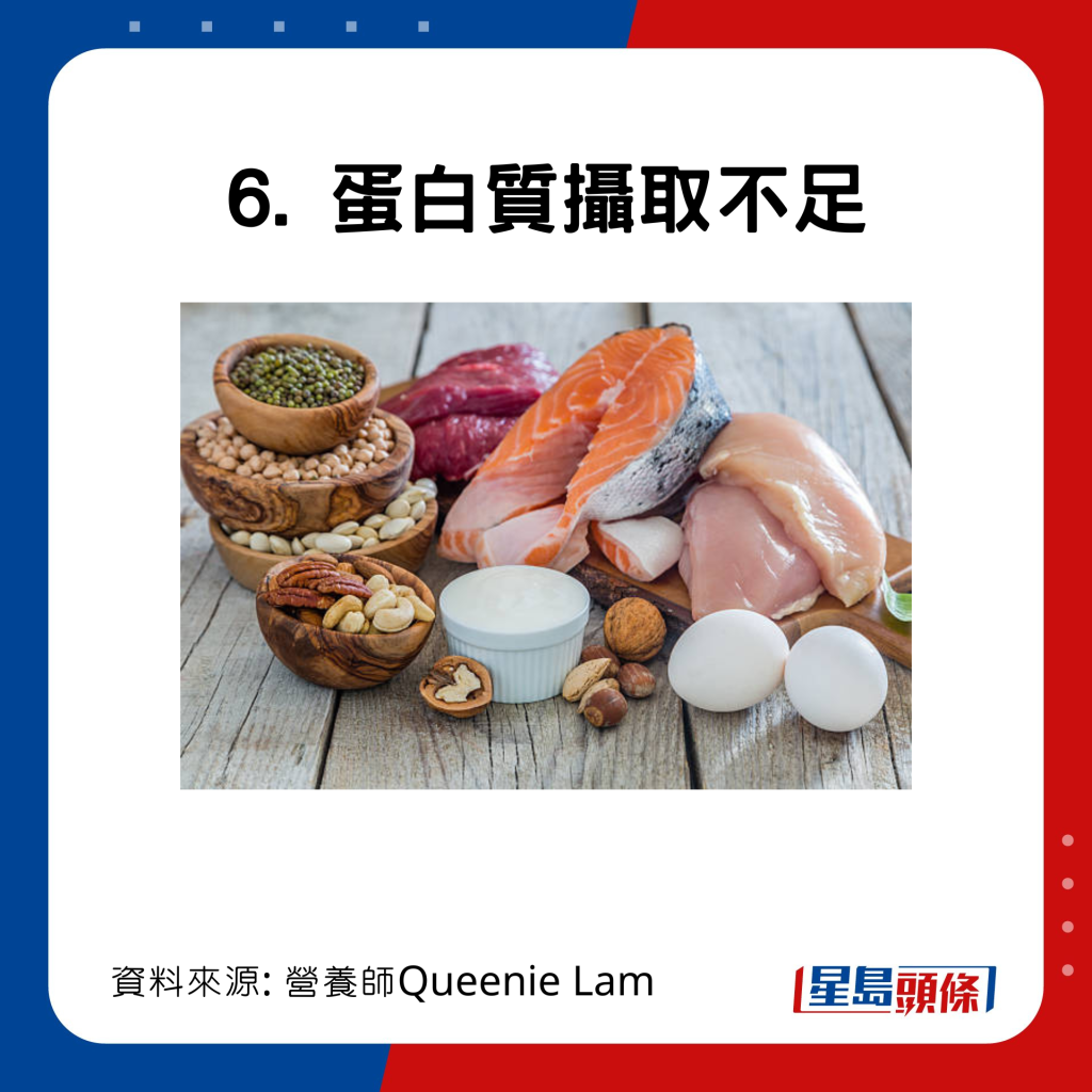 20221110_health_dryskin1_12