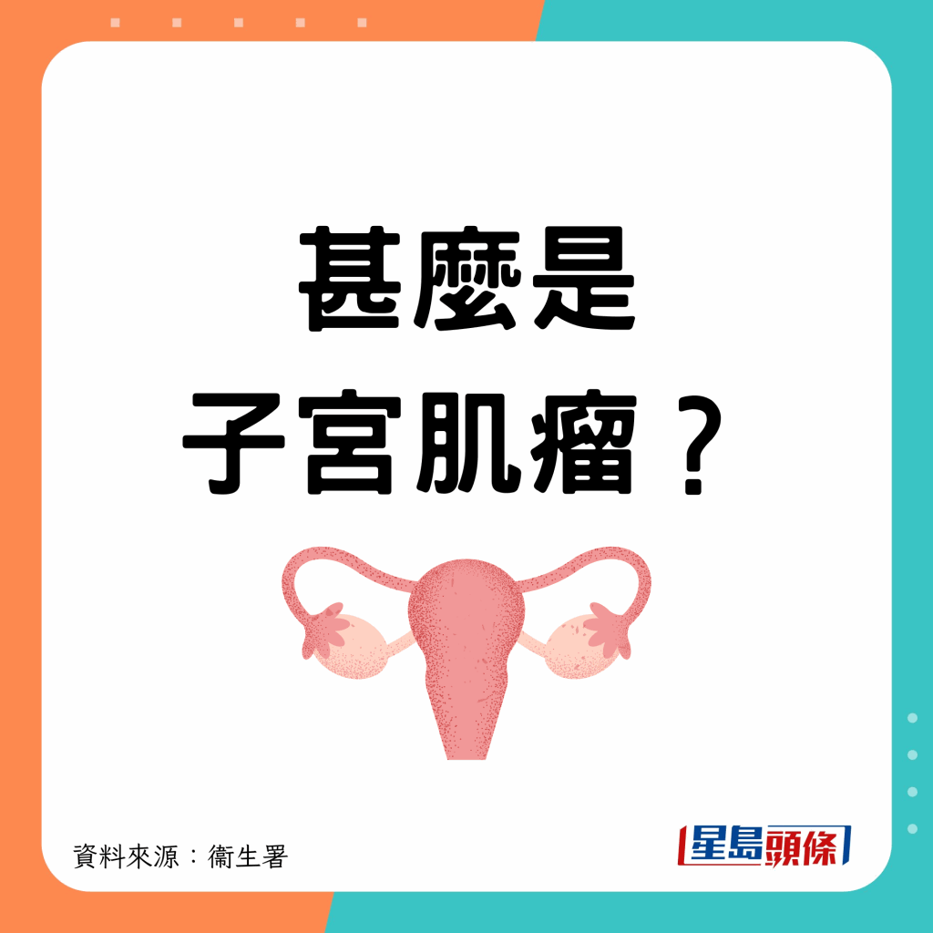UterineFibroid_A01