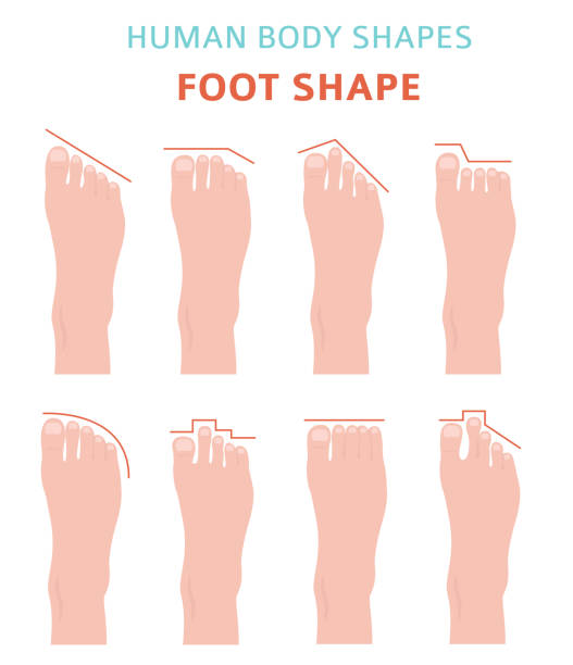 Human body shapes.Feet types icon set. Vector illustration
