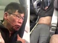 遭拖落機致腦部永久受損 杜成德：恐不能再做醫生