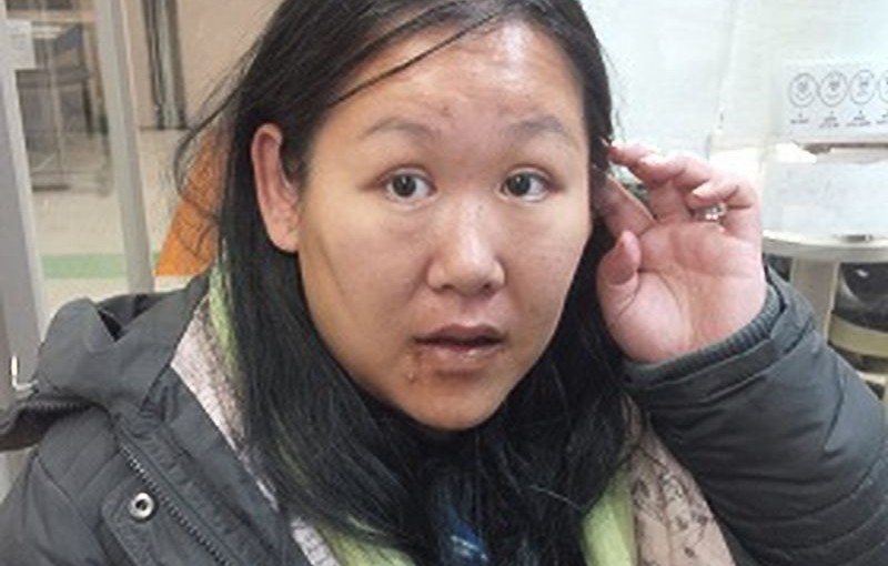 亞裔女想不起自己是誰 警靠公眾力量獲得其信息