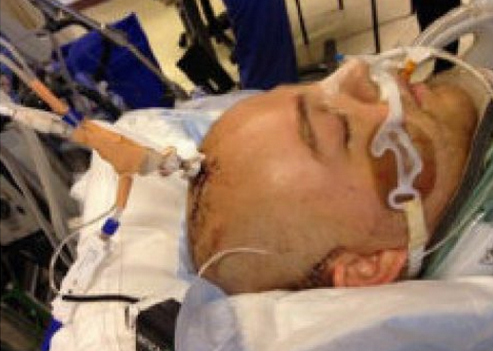 溫哥華竟流行一拳爆頭 已致三人死亡