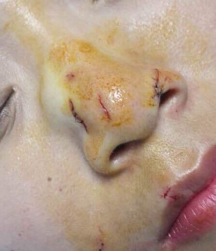 上海女遊客吻蛇被反咬 血流滿面