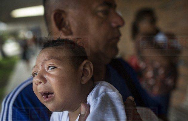 寨卡蚊疫蔓延美洲 威脅孕婦生畸型B