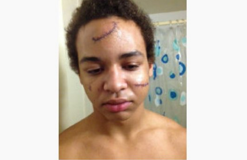 家長們當心！嵌絲玻璃會造成嚴重傷害