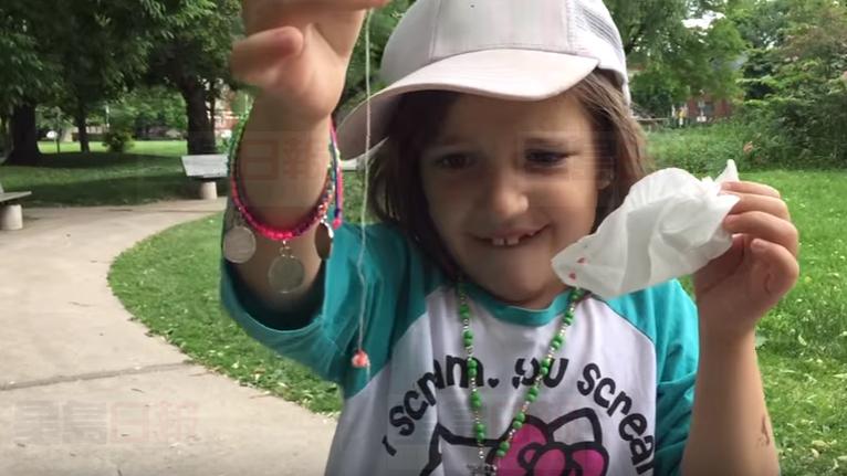 滿地可爸爸出奇招 讓松鼠幫愛女拔乳牙