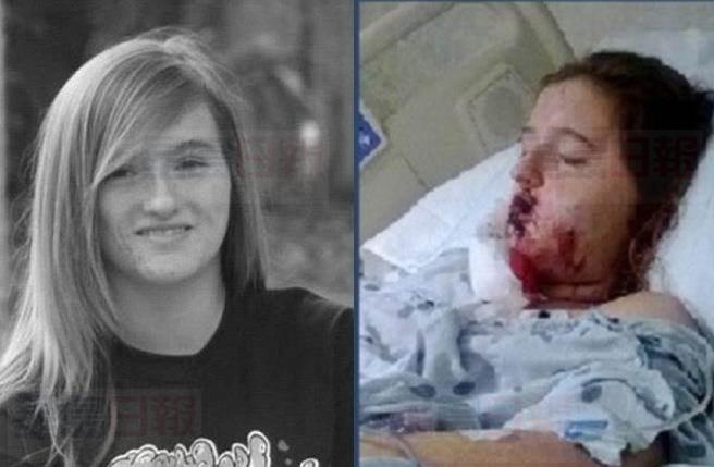 慘! 她溜滑板出門抓小精靈 遭車猛撞骨折耳聾