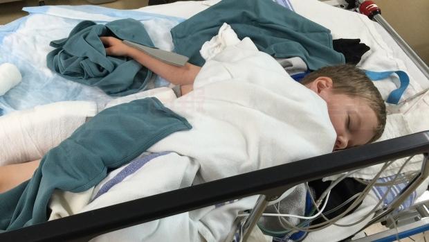 3歲男童Tim Hortons被大面積燙傷 皮膚如濕紙巾