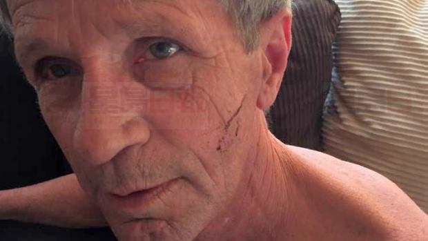 加拿大61歲老人空手與黑熊互搏 僅受輕傷