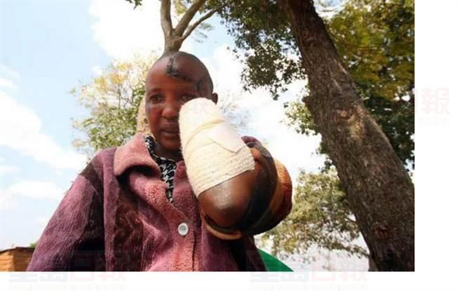 生不出孩子 性無能男剁妻雙手