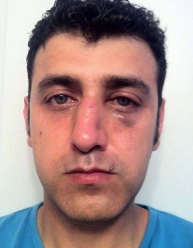 溫哥華男子星巴克講外語被揍