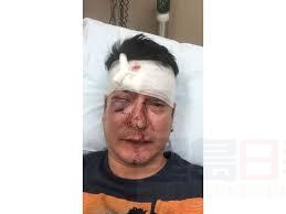 同性戀男子打招呼被誤認勾引 酒吧遭痛毆