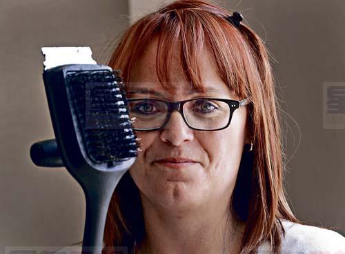 又有男童吞下BBQ鋼刷絲 這次手術移除