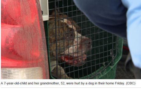 狗突然襲擊7歲女孩:像搖一個破玩偶