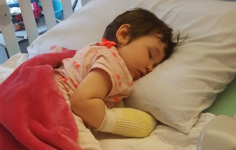 女孩上緬省無牌日托中心 期間手腕嚴重燒傷住院