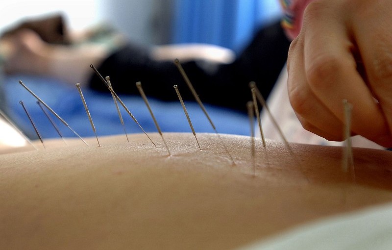 西醫慌了：中醫療法在加拿大逐漸受追捧