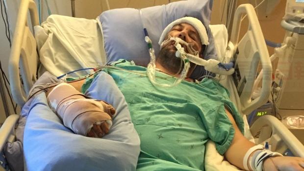 安省男子出車禍當天保險變規定 2百萬賠償變8.6萬