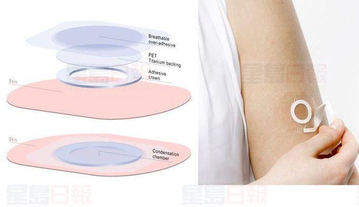 花生過敏者喜訊 皮膚貼片可減不適