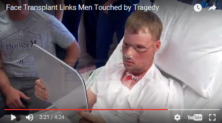 吞槍自殺毀容 絕望男子11年后換臉獲新生