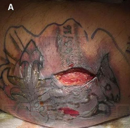 無視警告墨西哥灣游泳 美國新紋身男子不治