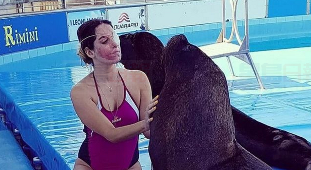 臉遭前男友潑強酸  意大利選美模特復出