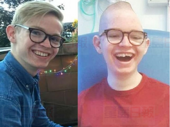 少年車禍頭骨變形 母公佈照片揭酒駕害人