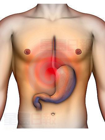 長期使用抗燒心類藥物可能導致早逝