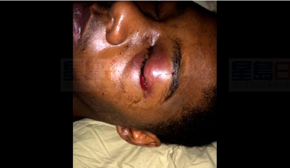 休班警察和兄弟街頭狂毆19歲男子致失明