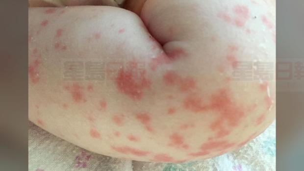 加國新生兒器官衰竭瀕臨死亡！罪魁禍首竟是它！