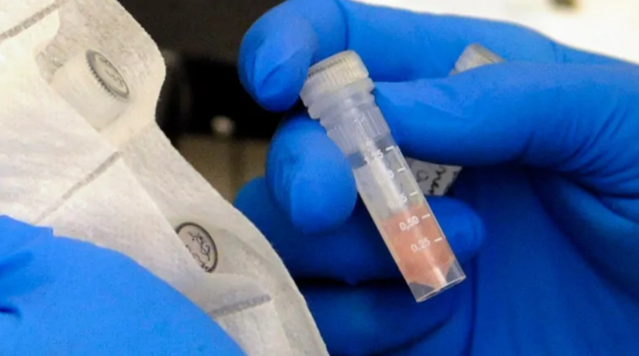 細菌性腦膜炎易傳染極危險  18歲加國少女感染後死亡