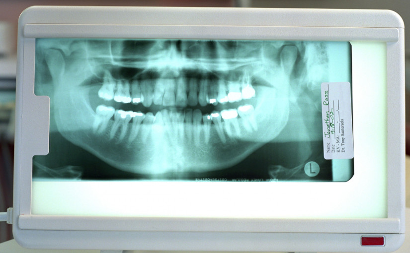 安省擬推低收入長者免費牙醫服務