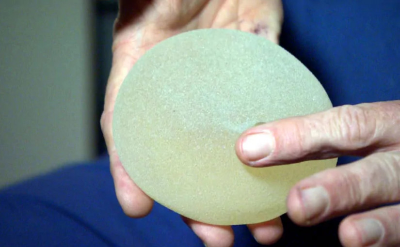 紋理值入物隆胸人士患罕有癌症風險增 醫生籲須留意徵狀