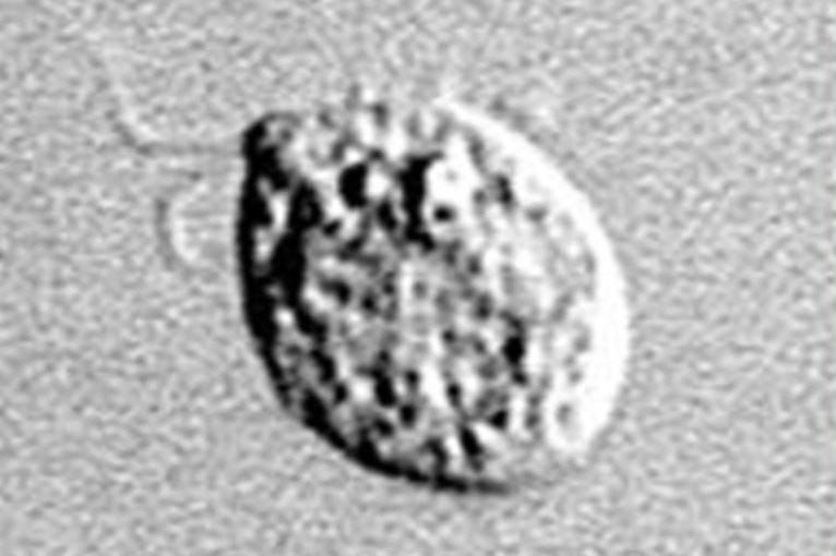 美國男子水上樂園游泳  吸入食腦變形蟲喪命