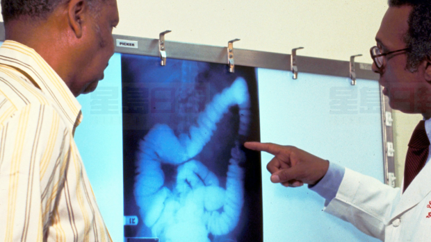 你的飲食健康嗎？ 加國年輕人患大腸癌比率增加