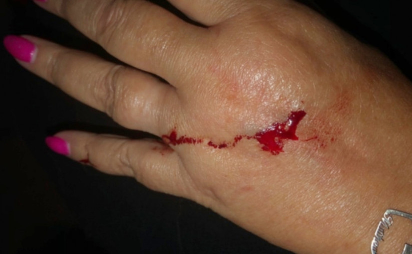 下水道工程趕出鼠群   士嘉堡早午晚皆見鼠蹤