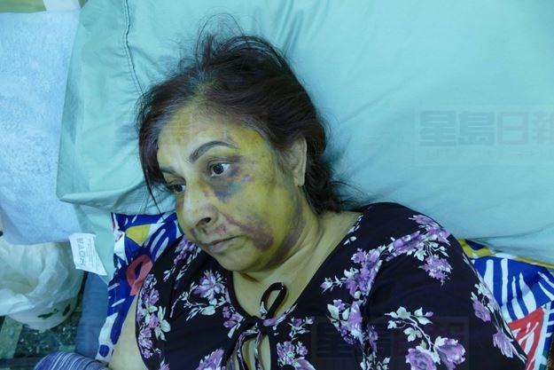 婦人應門遭2擎槍漢毒打 警方懷疑匪徒入錯屋打錯人