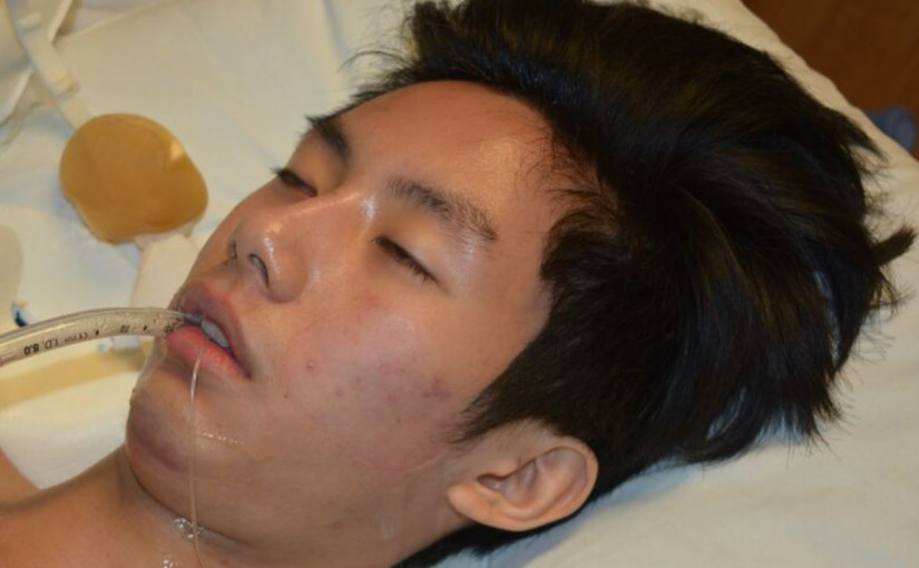 亞裔男子北約克受傷 身份待確認