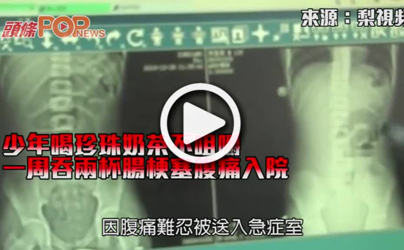 少年喝珍珠奶茶不咀嚼      一周吞兩杯腸梗塞腹痛入院