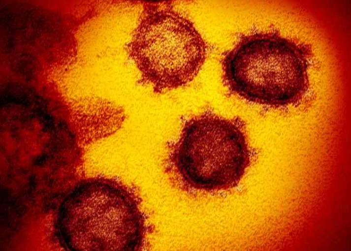 若新冠肺炎在加爆發 加國醫院能承受嗎？