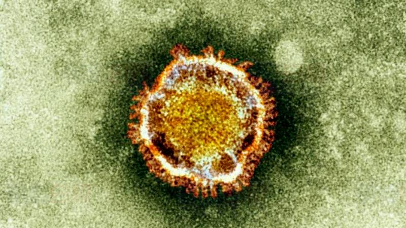 卑詩省210人接受新型冠狀病毒測試 確診或假設受感染維持4人