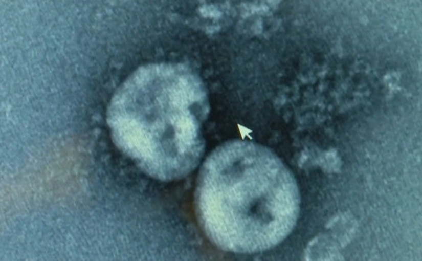 加航證實一名乘客確診感染新型冠狀病毒 多倫多增一確診患者