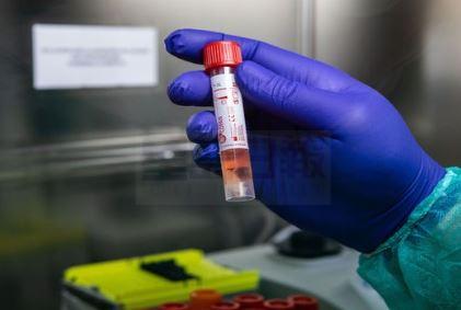 華裔男子涉嫌出售偽造病毒檢測套件詐騙被捕