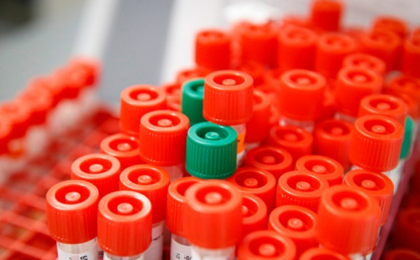 研究發現新冠病毒空氣中可存活數小時