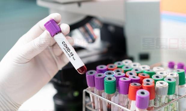 安省周三再添329人染疫 總感染升越21000人